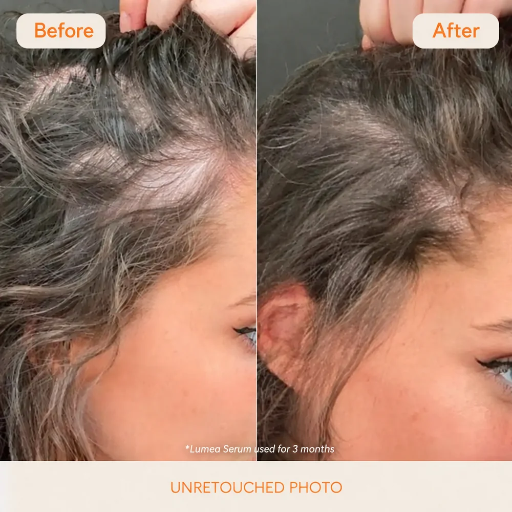 Lumea Hair Serum
