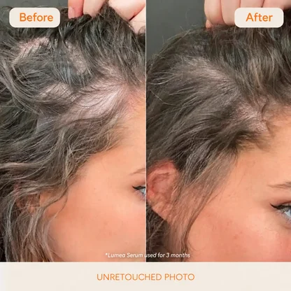 Lumea Hair Serum